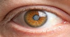 白内障治療と眼圧管理: 両方の健康を守るためのガイドライン