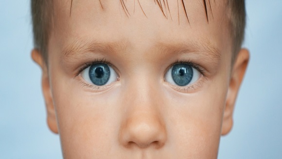 白内障と瞳孔不同の関係とは？
